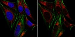 Mediator complex subunit 25 Rabbit anti-Mouse, Human, Polyclonal, MilliporeSigma